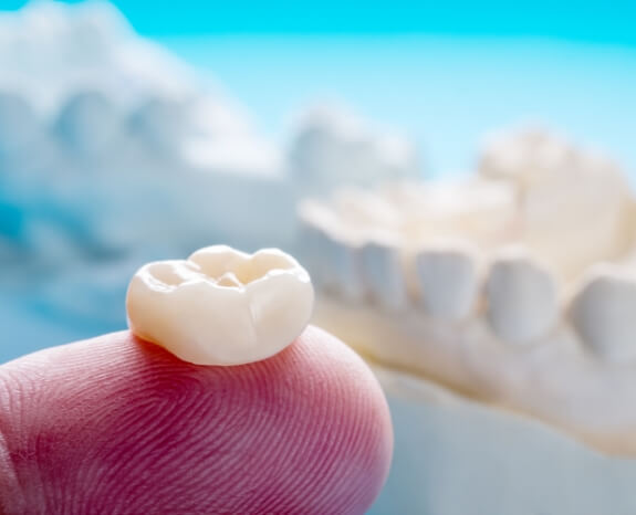 Dental crown resting on fingertip