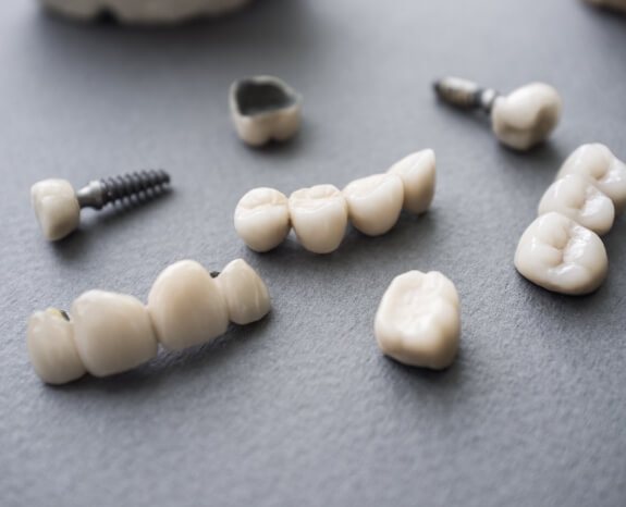 Dental crown and fixed bridge restorations compared prior to placement