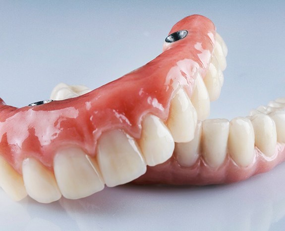 implant dentures on a counter 