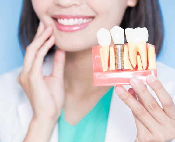 Dentist holding dental implant model